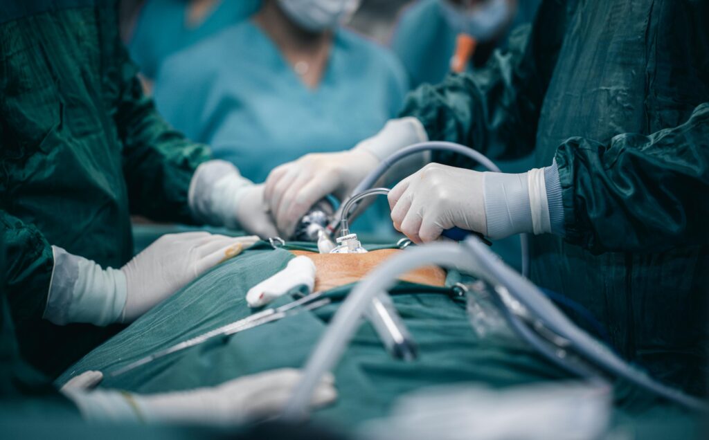 a patient under anesthesia surrounded by surgeons and nurses